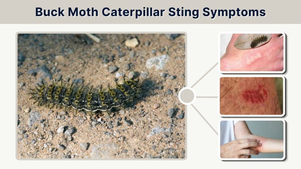 Buck Moth Caterpillar Sting Symptoms