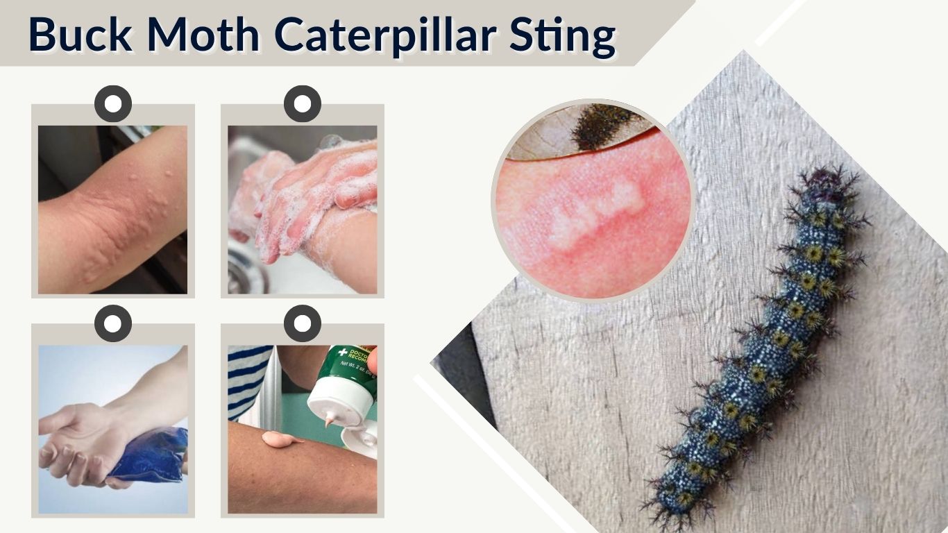 Buck Moth Caterpillar Sting: Symptoms, Treatment and Pictures