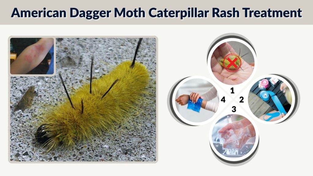 American Dagger Moth Caterpillar Rash Treatment