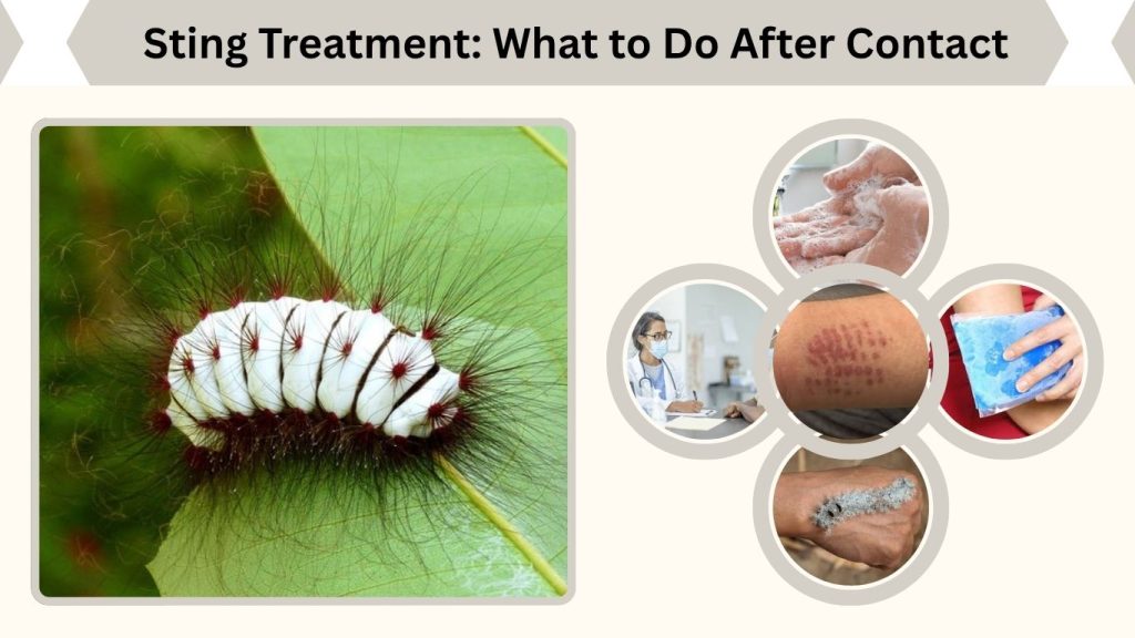 Sting Treatment: What to Do After Contact