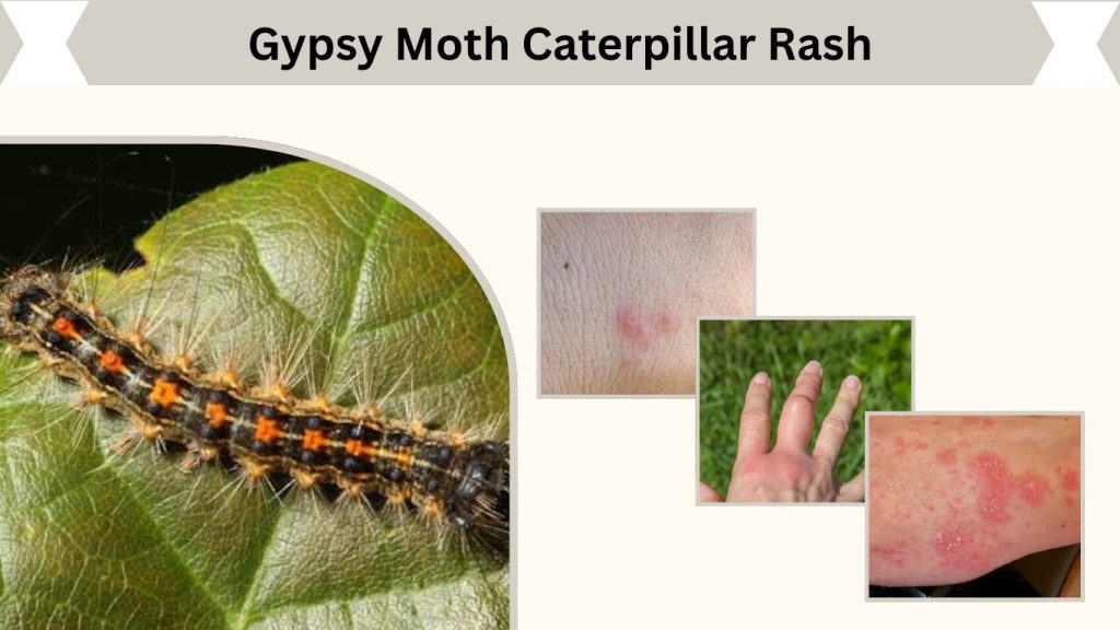 Gypsy Moth Caterpillar Rash