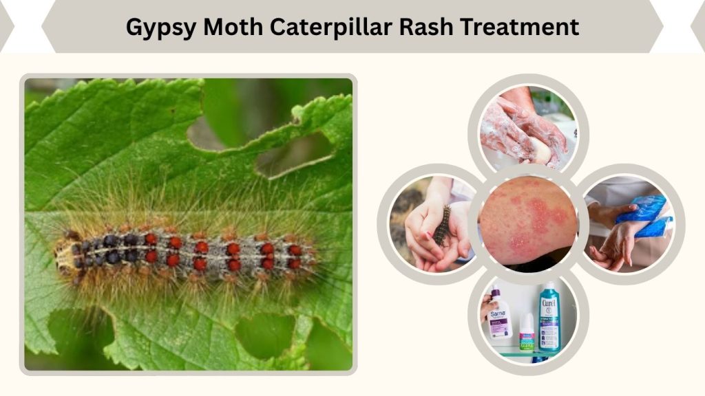 Gypsy Moth Caterpillar Rash Treatment