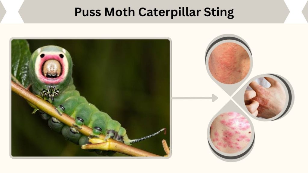 Puss Moth Caterpillar Sting