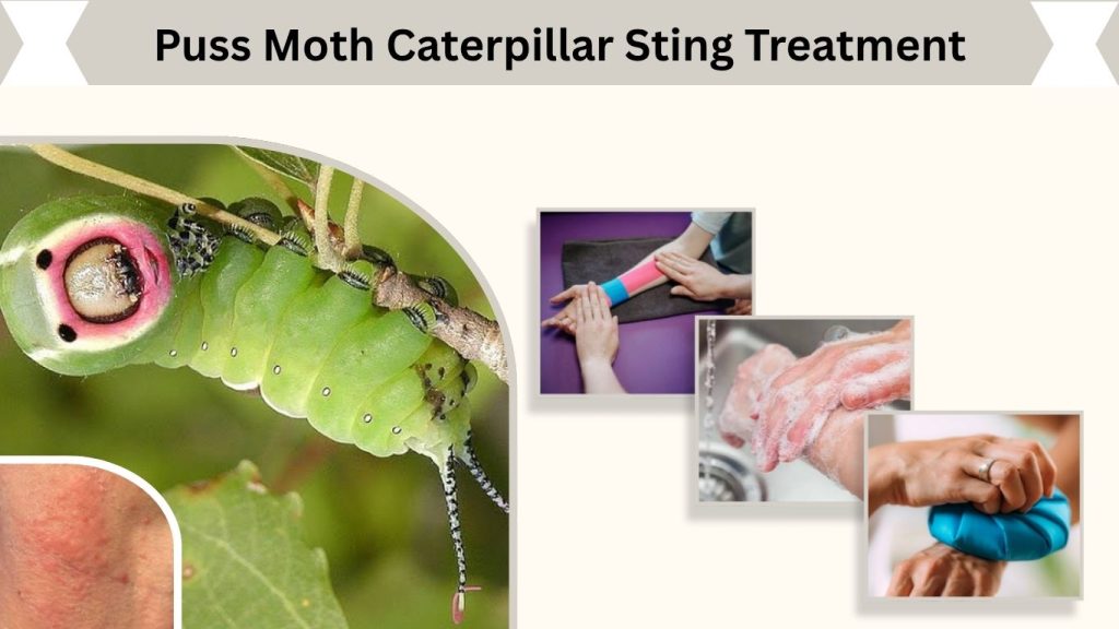 Puss Moth Caterpillar Sting Treatment