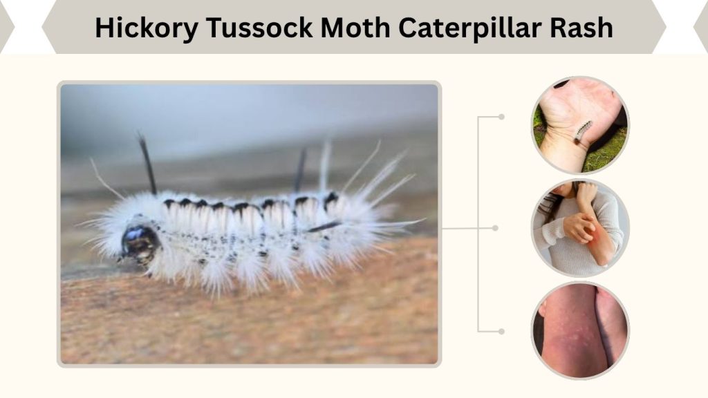 Hickory Tussock Moth Caterpillar Rash
