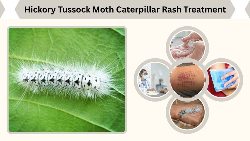 Hickory Tussock Moth Caterpillar Rash Treatment