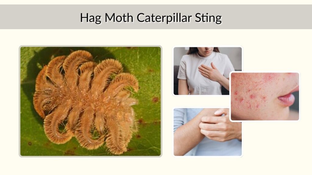 Hag Moth Caterpillar Sting