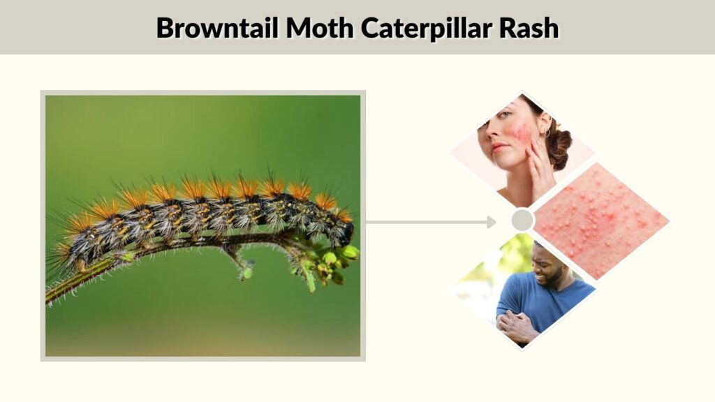 Browntail Moth Caterpillar Rash
