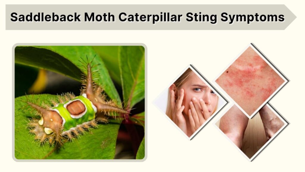 Saddleback Moth Caterpillar Sting Symptoms