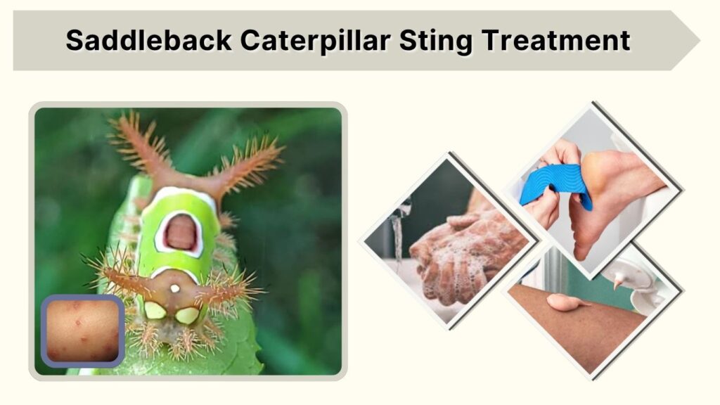 Saddleback Caterpillar Sting Treatment
