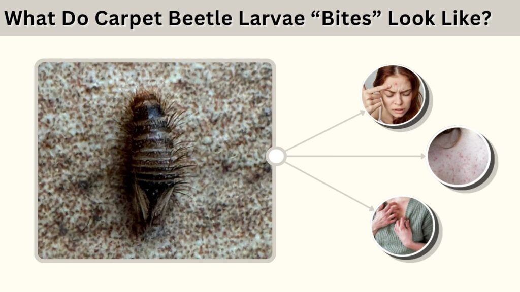 What Do Carpet Beetle Larvae “Bites” Look Like?