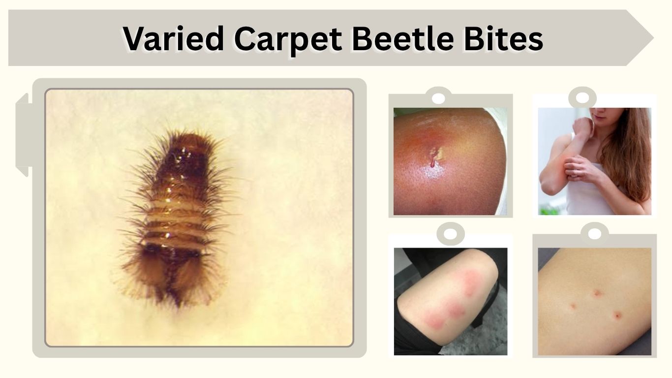 Varied Carpet Beetle Bites: Do They Bite Humans?