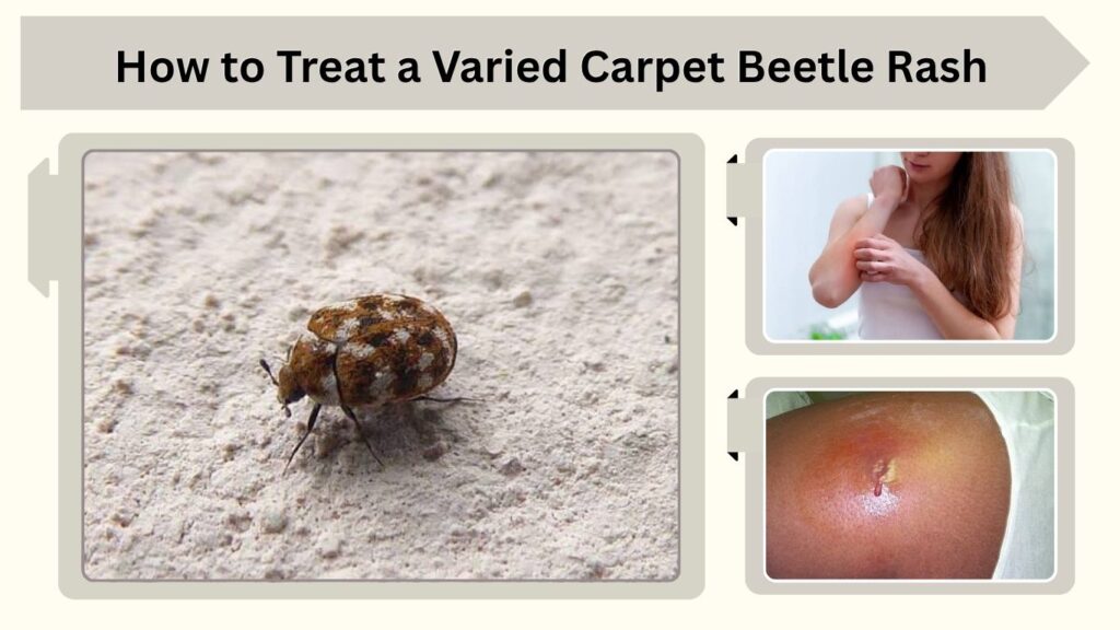 How to Treat a Varied Carpet Beetle Rash
