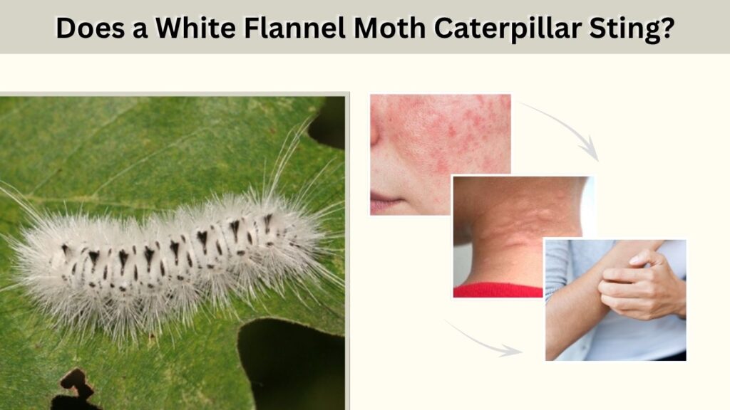 Does a White Flannel Moth Caterpillar Sting?