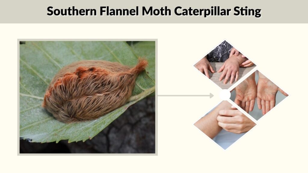 Southern Flannel Moth Caterpillar Sting