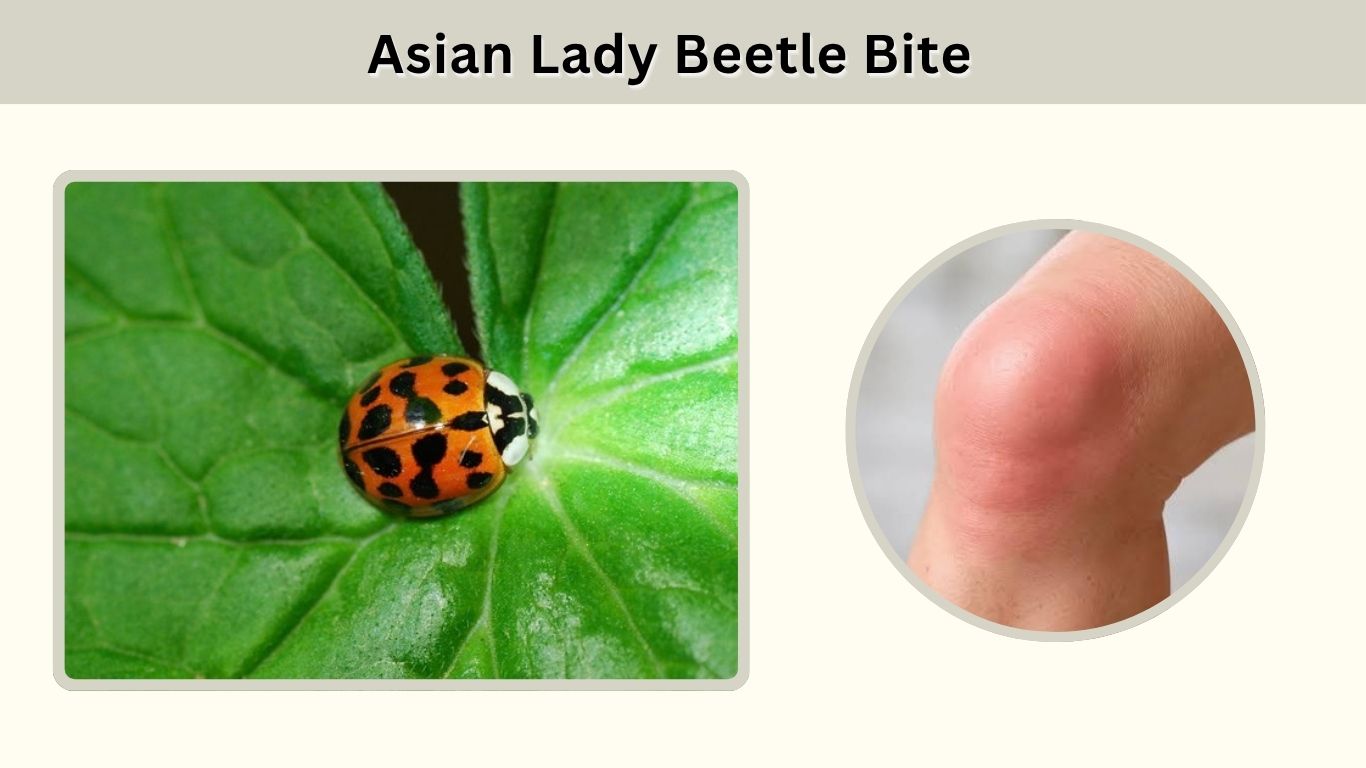 Asian Lady Beetle Bite: Symptoms, Marks & Treatment