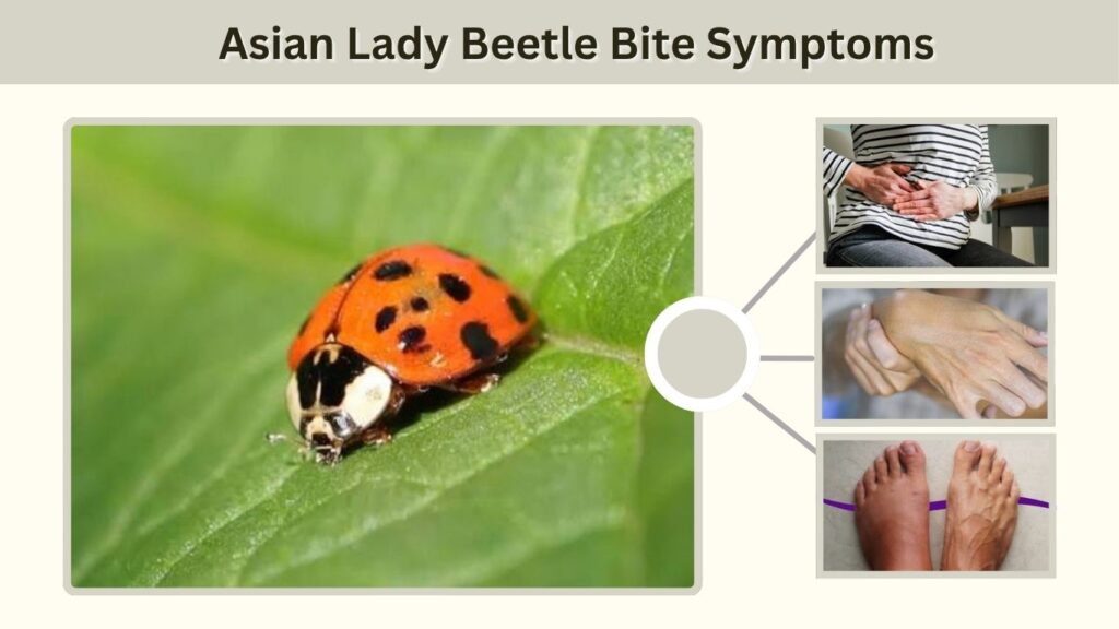 Asian Lady Beetle Bite Symptoms