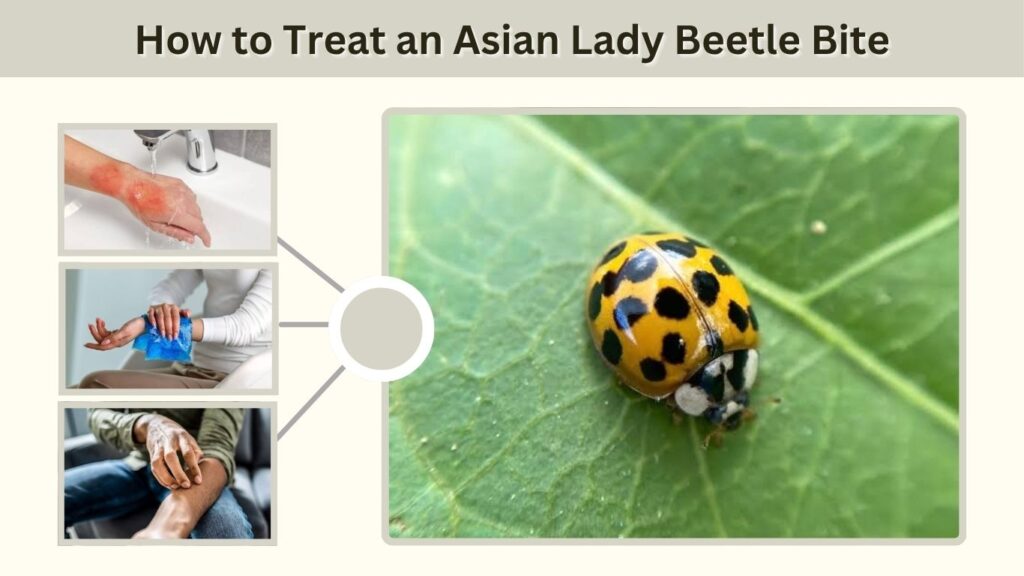 How to Treat an Asian Lady Beetle Bite