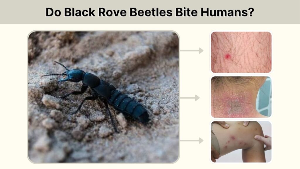 Do Black Rove Beetles Bite Humans?